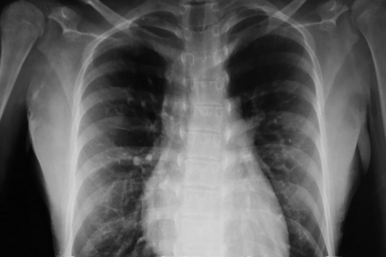 Radiographer Positioning A Patient For A General X Ray At A Radiology Clinic In Albury
